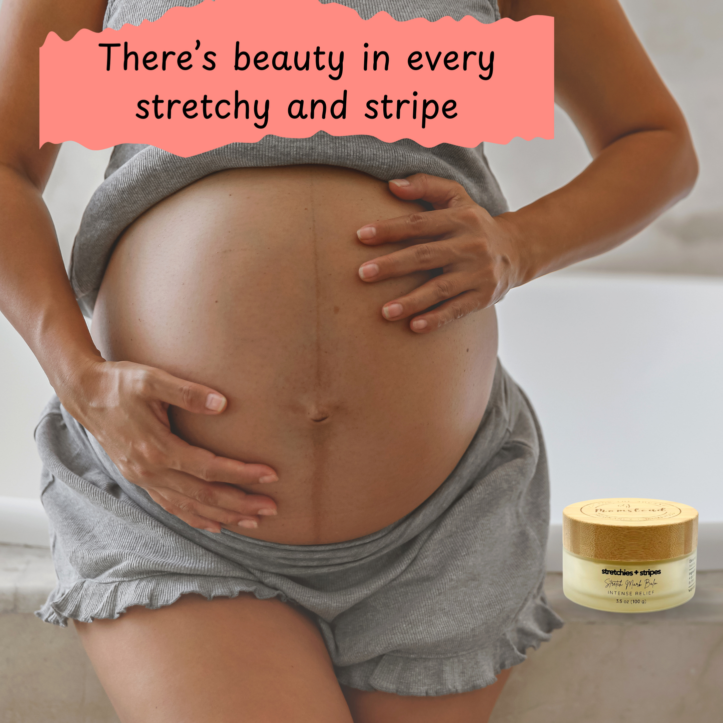 Momstead Stretchies and Stripes Stretch Mark Balm for pregnancy, postpartum, itchy mama skin.